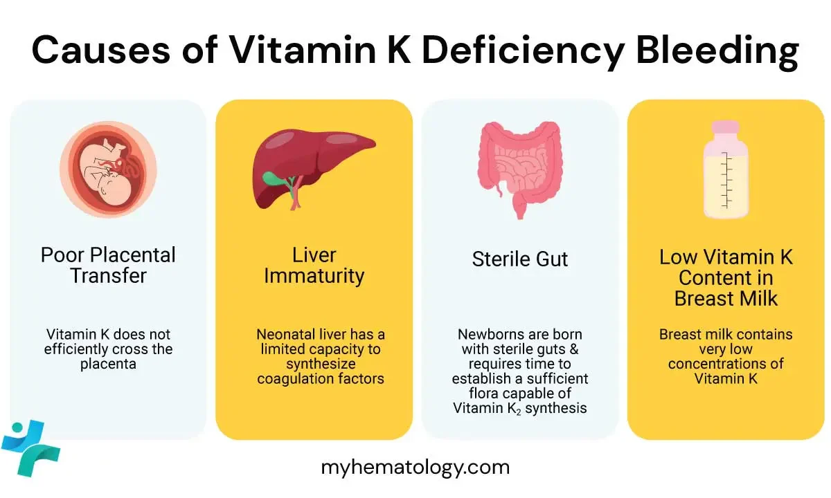 vitamin k deficiency infant bleeding refusal